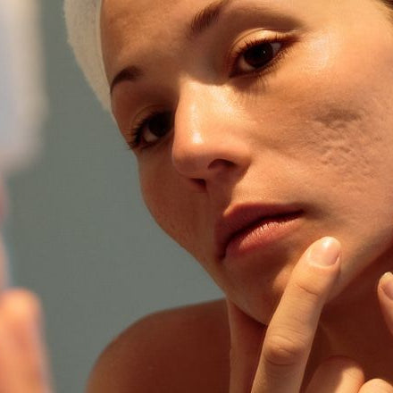 How Do I Know If I Have Sensitive Skin?