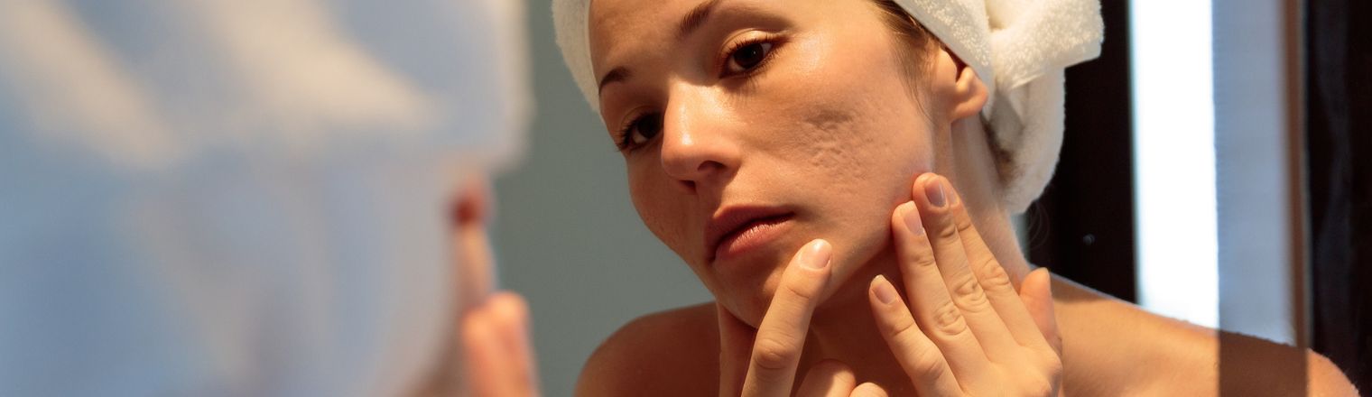 How Do I Know If I Have Sensitive Skin?